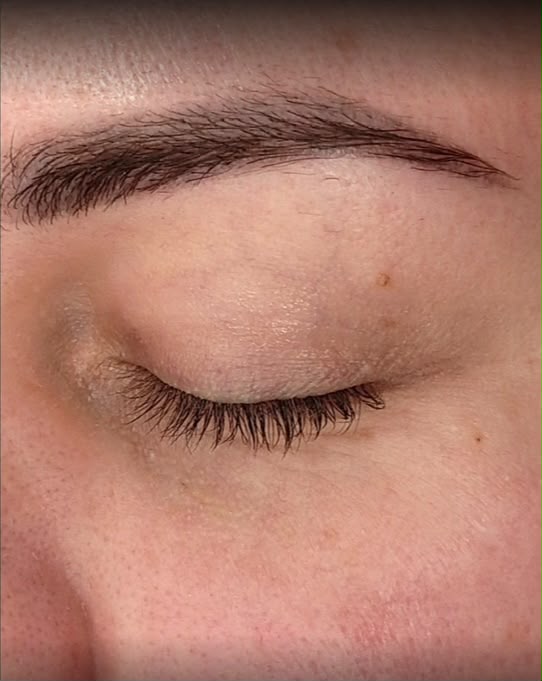Voor: fijne lijntjes rond het oog